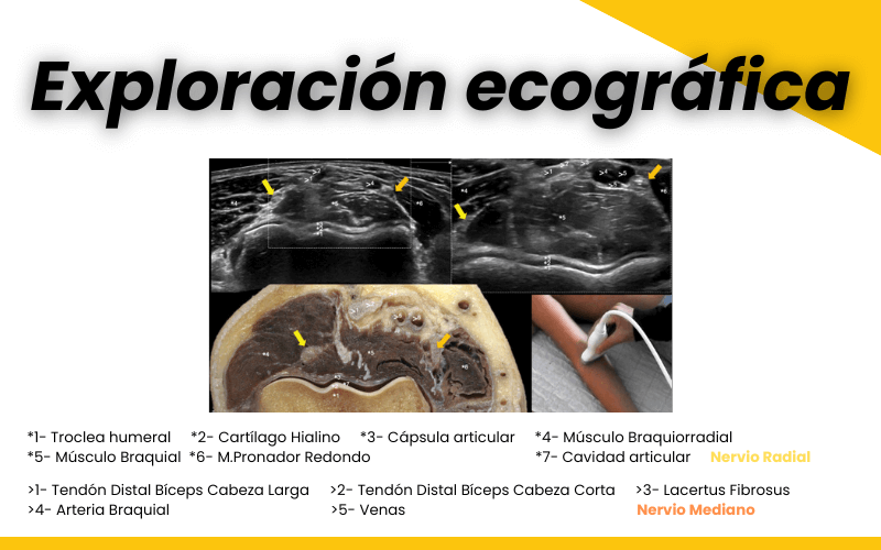 299. Anisotropía Tendón del Bíceps. – Ecografía Fácil