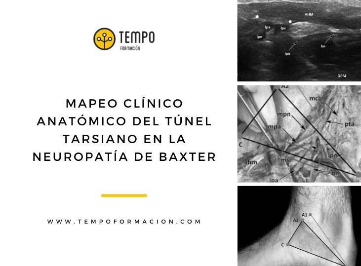 exploracion-clinico-anatomica-del-tunel-del-tarso-con-relacion-a-la-neuropatia-de-baxter