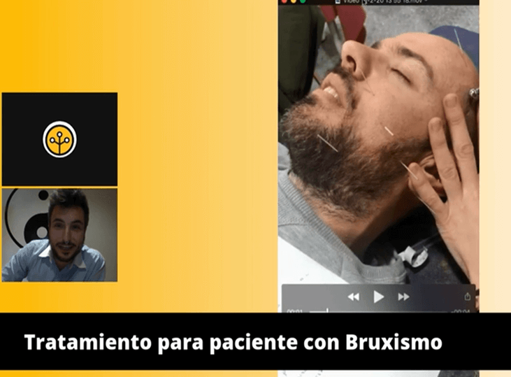 bruxismo-tratamiento-con-electroneuroacupuntura