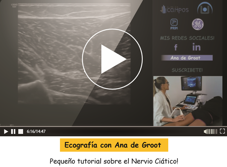 tutorial-nervio-ciatico-ana-de-groot
