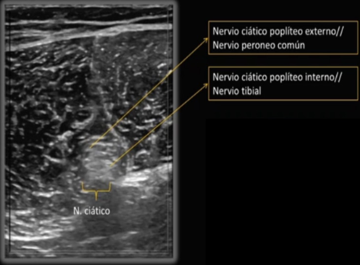 neurodinamia-ecografia-con-ana-de-groot