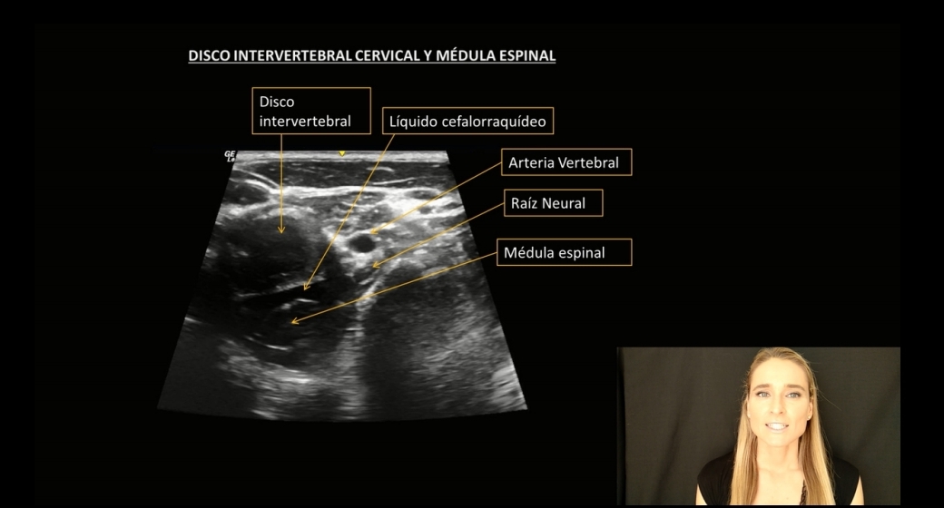 aprendiendo-ecografia