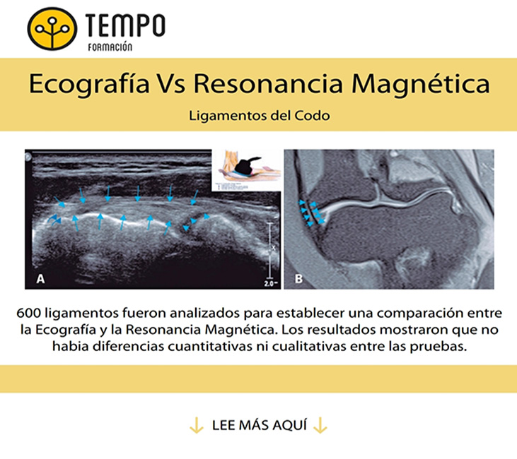 ecografia-vs-resonancia-magnetica