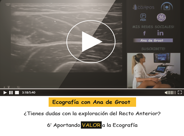 tutorial-recto-anterior-ana-de-groot