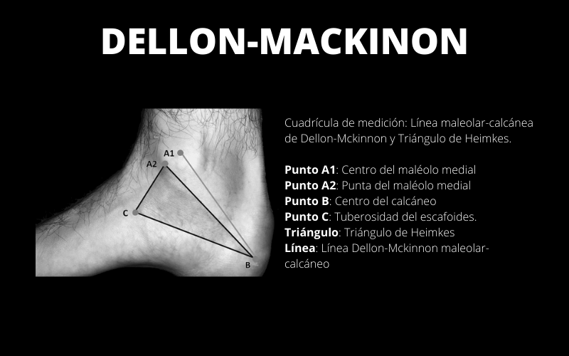 Dellon-Mackinon.png
